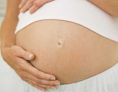 como evitar estrias dicas para mamãe