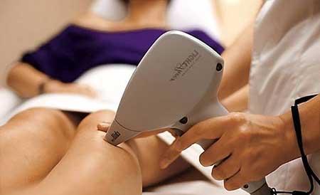 Depilação a Laser tratamentos para remoção de pelos