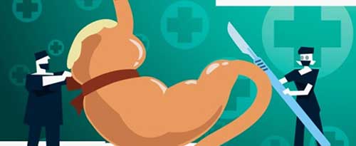 A gastroplastia desenho personalizado