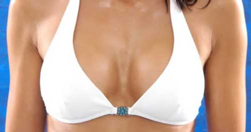 Mamoplastia também para homens